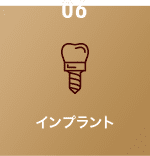 インプラント